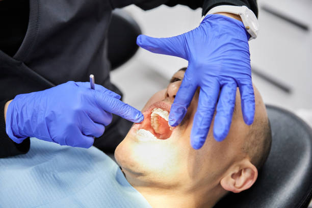 Best Emergency Wisdom Teeth Removal in Kilgore, TX