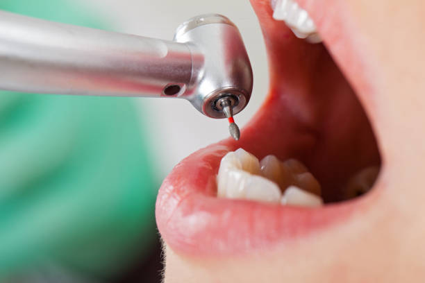 Best Emergency Denture Repair in Kilgore, TX